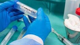 Ricerca, nella saliva 2 spie della demenza a corpi di Lewy, studio Sapienza