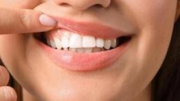 Salute ‘in 70% persone con autismo problemi a denti e gengive’, parodontologi in campo