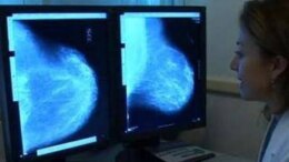 Donne operate per tumore al seno, 70% paga cure e 30% teme per il lavoro