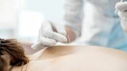 Tra aghi e neuroni, ‘oltre 2 mln di italiani scelgono l’agopuntura’