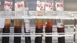 Aids, speranze da terapie long acting e PrEP, il punto degli infettivologi Simit