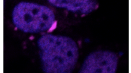 Ia, algoritmo Iit va a caccia di proteine dannose per il cervello