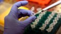 Morbillo, Pennsylvania segnala sesto morto: 39enne con patologie e già infettata di recente