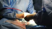 Operata al femore a 104 anni, già in piedi 24 ore dopo l’intervento