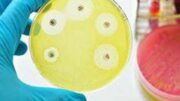 Ai e medicina di precisione per combattere super batteri resistenti, lo studio italiano su quasi 10.000 pazienti