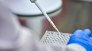 Idrosadenite suppurativa, alla Camera focus su Lea, Piano cronicità e innovazione terapeutica