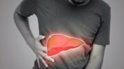 Steatosi epatica per 25% italiani, studio ‘integratore con alghe utile in 50% casi’