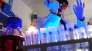 Storia genetica di un superbatterio killer, così l’Acinetobacter baumannii è diventato invulnerabile