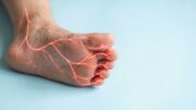 Asl Roma 4, presentato nuovo Pdta per neuropatia diabetica dolorosa
