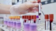 Hiv, dalla Sicilia il modello per estendere terapie long acting