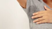 Svelato l’interruttore genetico che fa sudare troppo, nuove speranze per l’iperidrosi