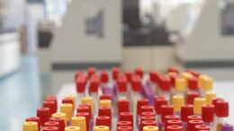 Cos’è il batterio mangiacarne sotto la lente a Messina, minaccia in crescita per il caldo record