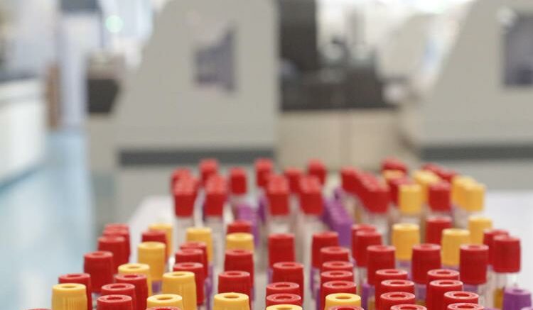 Malaria in aeroporto in Germania, gli esperti: “Campanello d’allarme, ma il rischio resta contenuto”