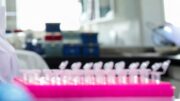 Milano, focolaio di tubercolosi all’Istituto di Medicina legale: 8 casi conclamati e 7 positivi. Indagini sull’origine del contagio