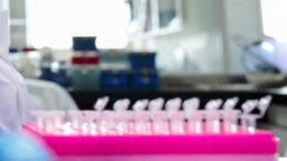 Milano, focolaio di tubercolosi all’Istituto di Medicina legale: 8 casi conclamati e 7 positivi. Indagini sull’origine del contagio