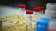 Difterite, quali rischi? Dalla trasmissione alla vaccinazione, ecco cosa sapere