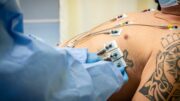 Prevenzione prima arma contro le malattie cardiovascolari: ecco le 5 regole salva cuore