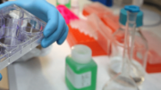 Tumori, al via studio per ridurre rischio recidive da cancro al seno
