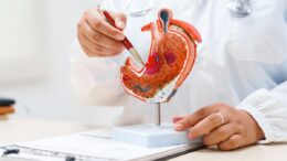 Cancro allo stomaco avanzato, nuova terapia riduce del 42% il rischio di morte ﻿