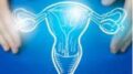 Cancro endometrio avanzato, nuove terapie migliorano sopravvivenza