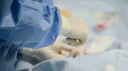 ‘Miracolato’ tre volte: a 85 anni supera terza rottura aorta con complesso intervento